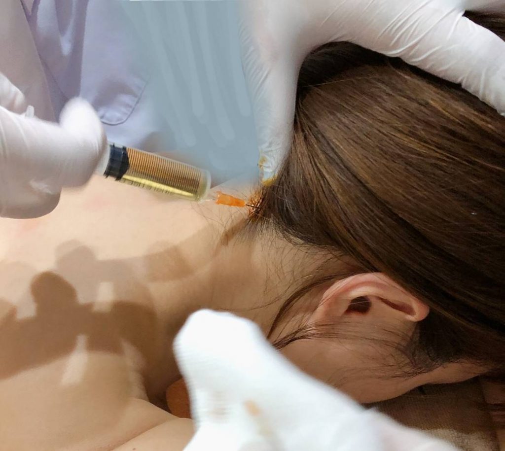 肩こり注射のモニター画像です。Dr.ゴトーが吉沢明歩さんの首のツボに肩こり注射を注入している画像です。